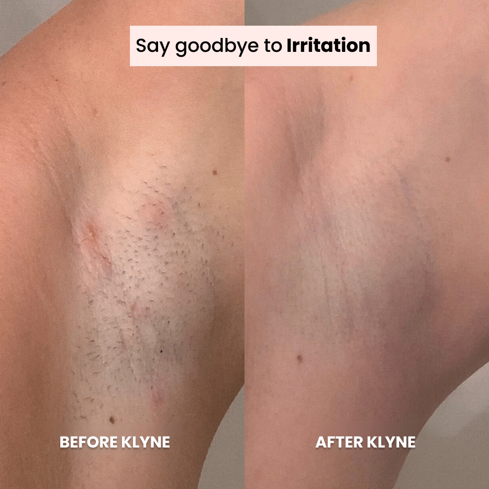 Klyne® Shaver